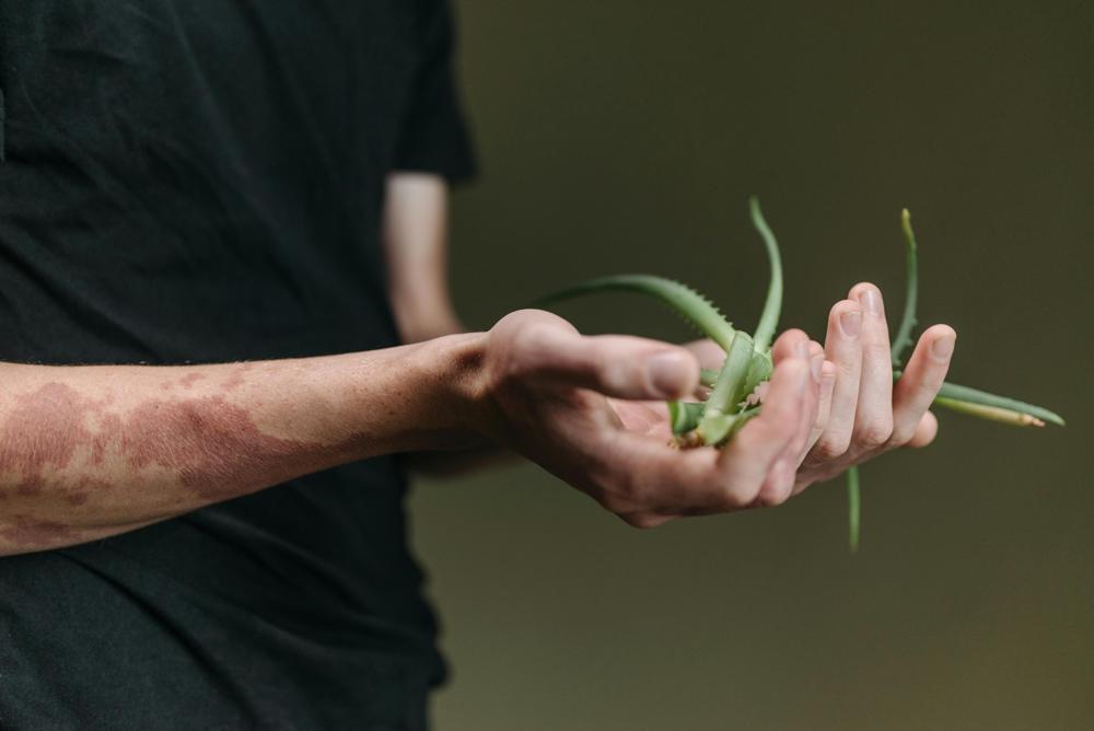 aloe vera