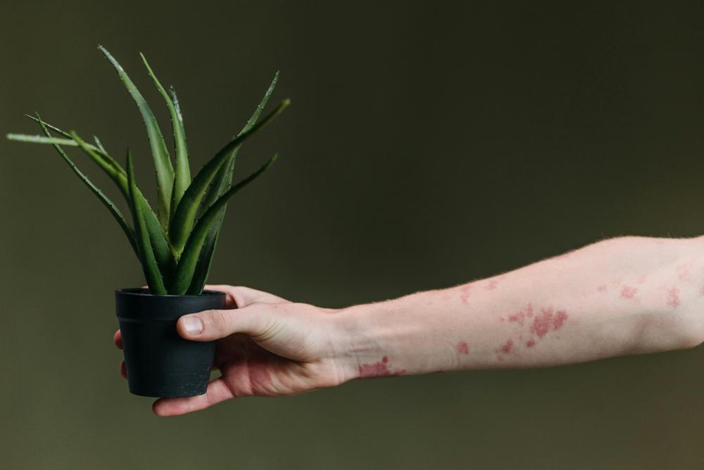 aloe vera-3b3654fb21f94667b63f0f96cf56f802.jpg aloe vera